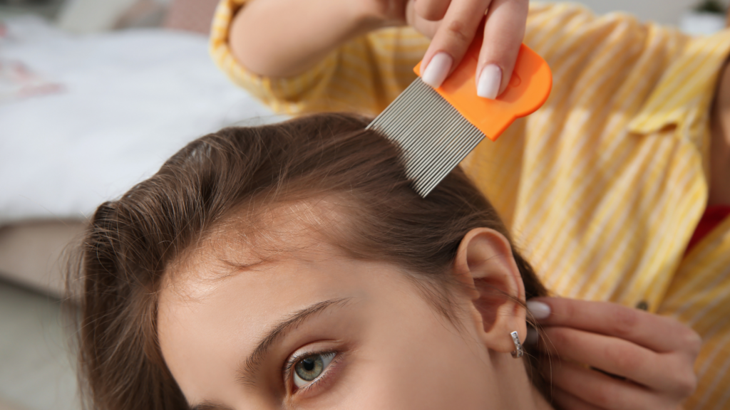 Care Tips After Lice Removal